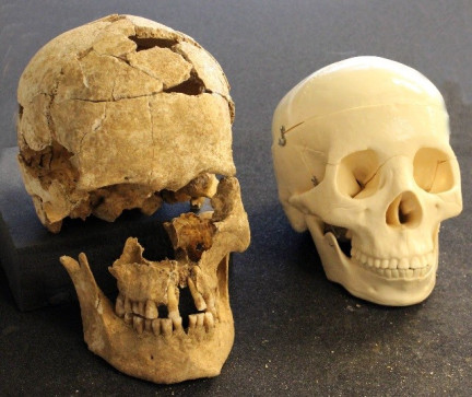 Grey table with two skulls next to each other. The Dalton Parlours skull with missing pieces before the conservation work and a plastic skull next to it to help the reconstruction